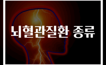 뇌혈관질환 종류 및 특징 총정리 30선