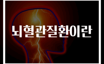 뇌혈관질환 원인과 예방법 완벽 가이드