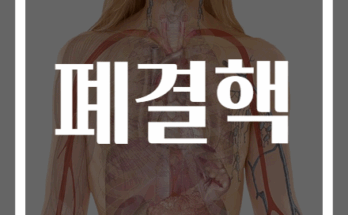 폐결핵 증상 및 치료법 완벽 가이드